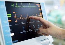 دستگاه نوار قلب یا الکتروکاردیوگراف
